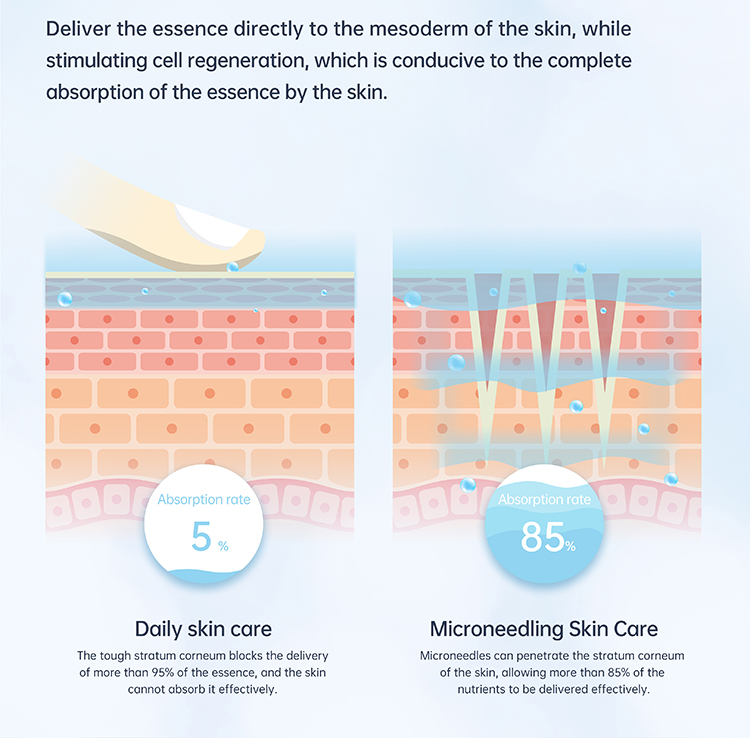 derma pen at home
