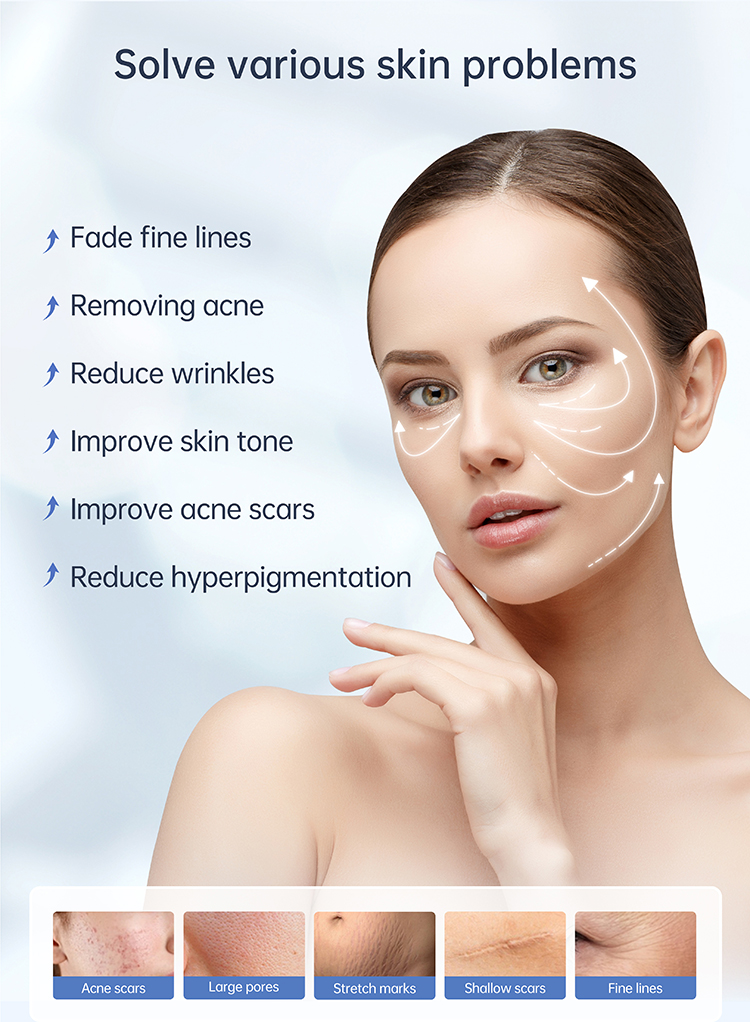 derma pen at home