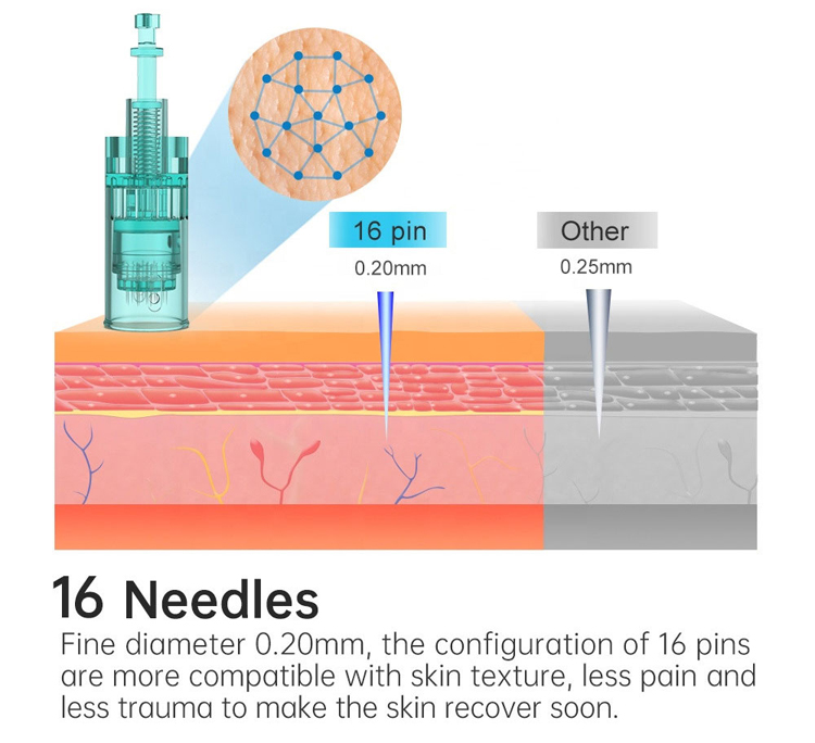 skin pen microneedling