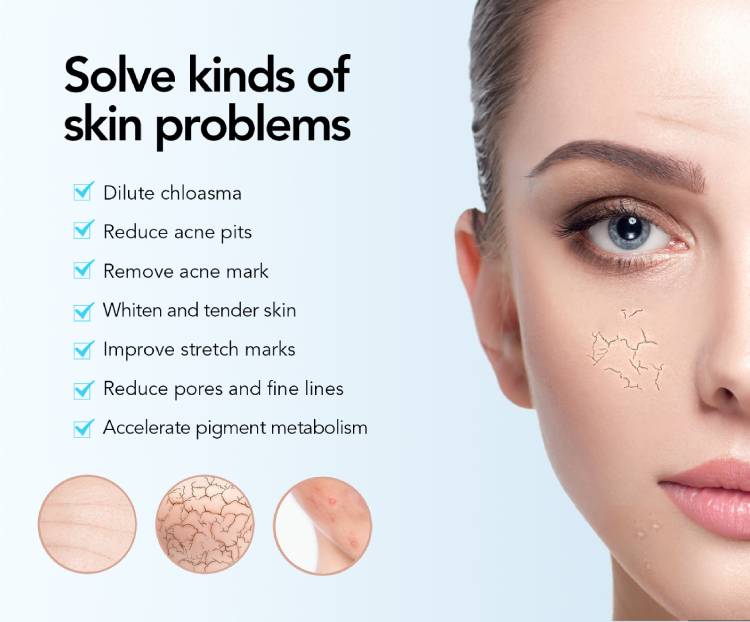 derma pen before and after