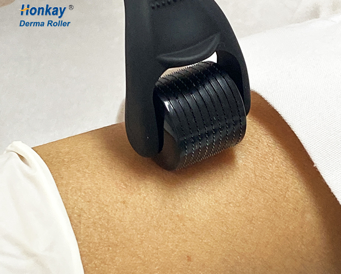 hair growth derma roller