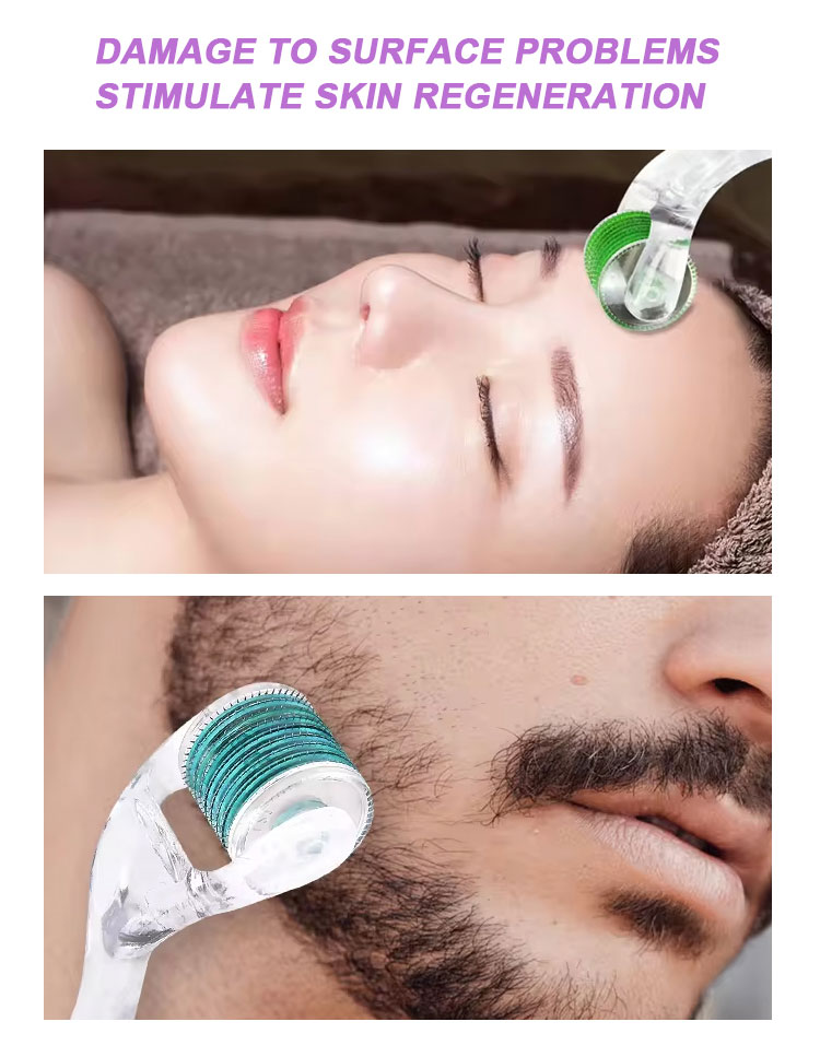 derma roller 540 needles for hair