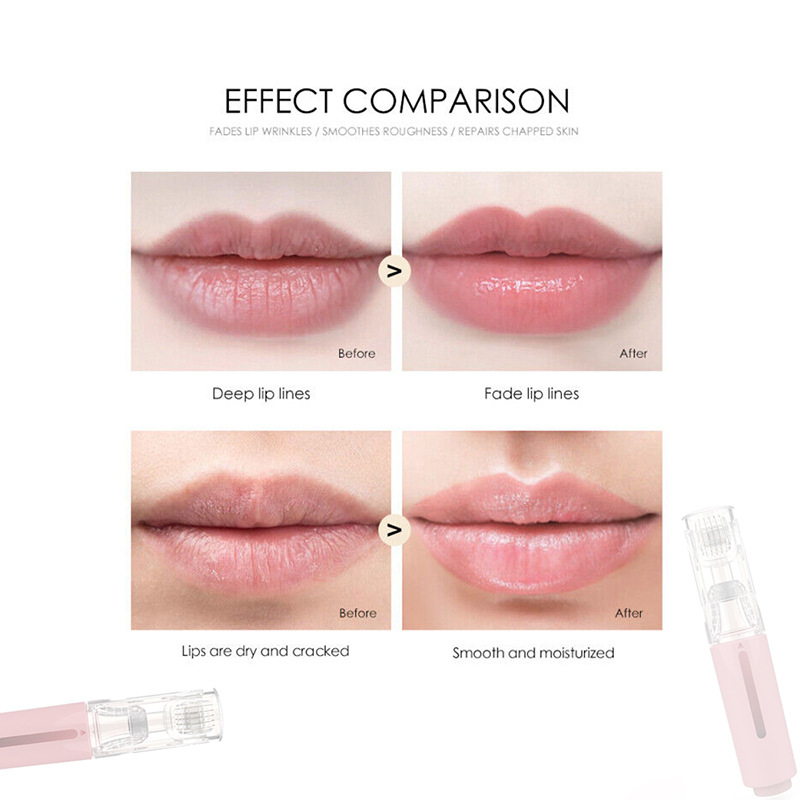 derma roller lip care pen
