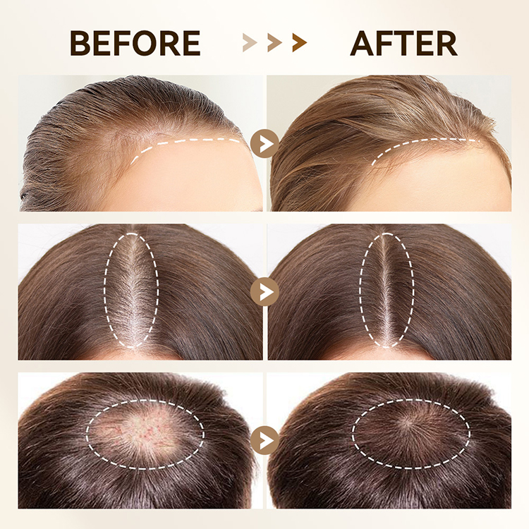 bio needle derma stamp