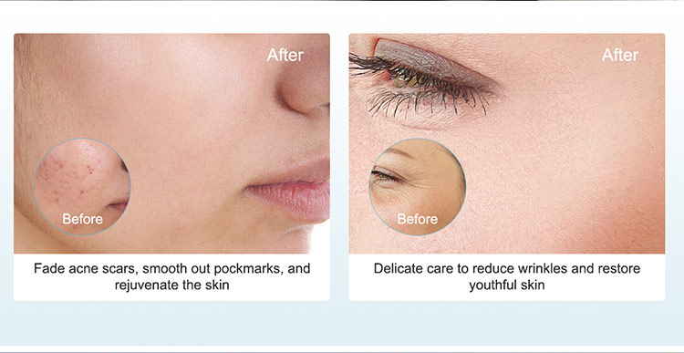 professional hydra microneedling pen m20