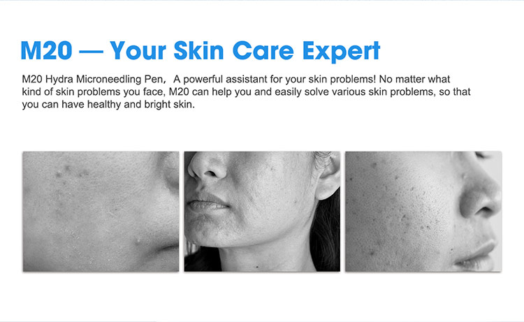 professional hydra microneedling pen m20