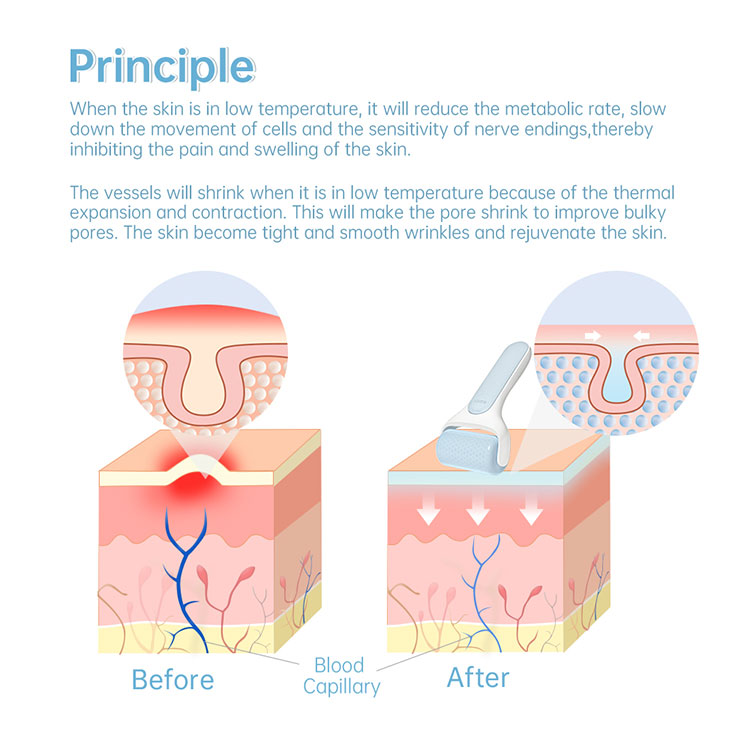 ice roller facial